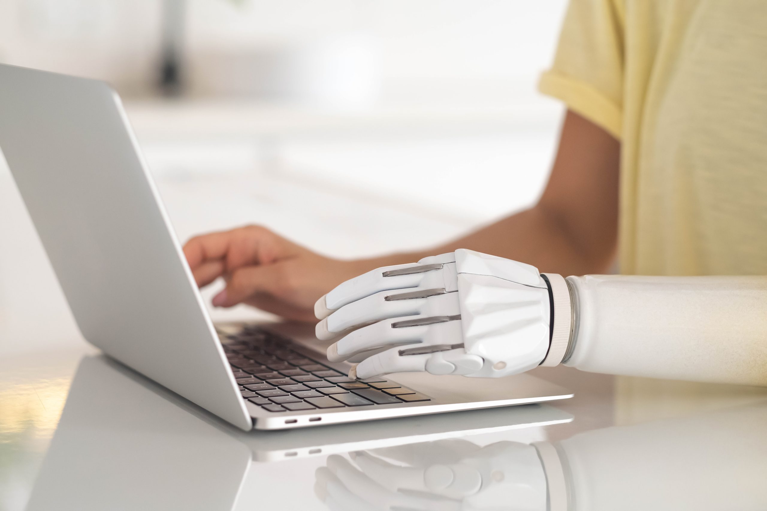 Hér sést í hendur að vinna í tölvu en önnur hendin er gervihendi.